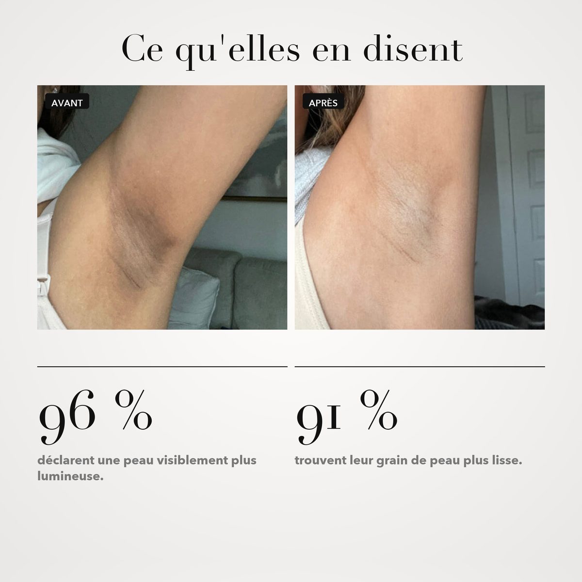 Peeling Éclat