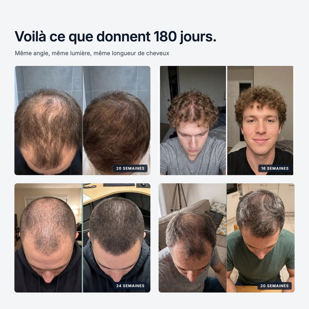 Avant et après : ce que donnent 180 jours