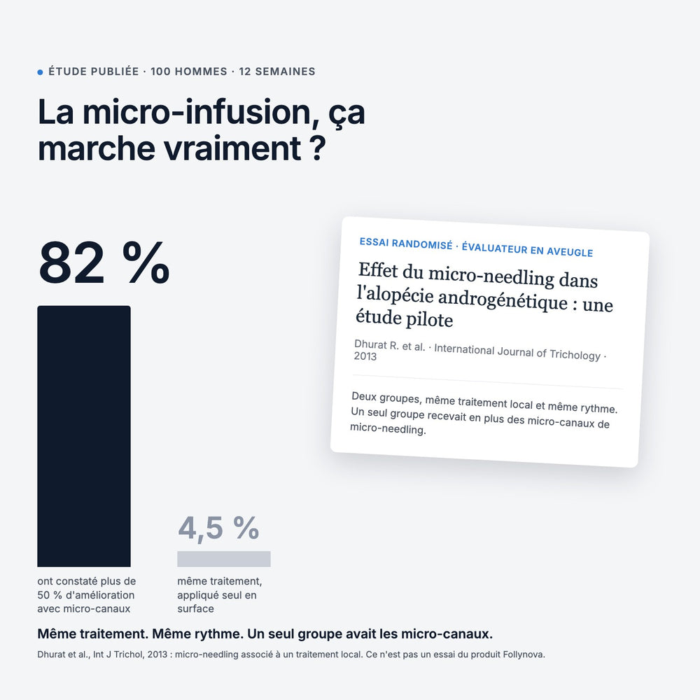 Étude publiée sur le micro-needling