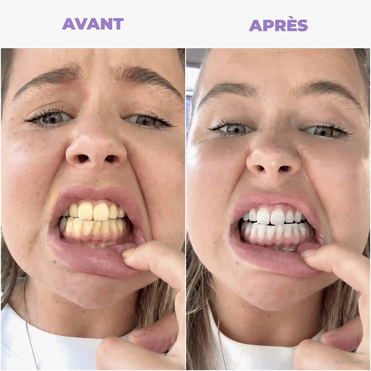 Avant / Après