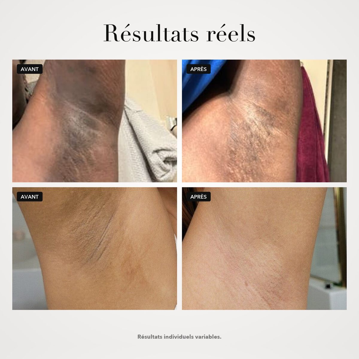Peeling Éclat